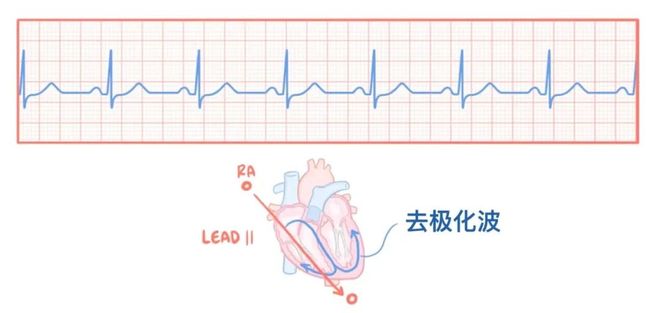 小技巧丨心电图原来可以这样看：省心！